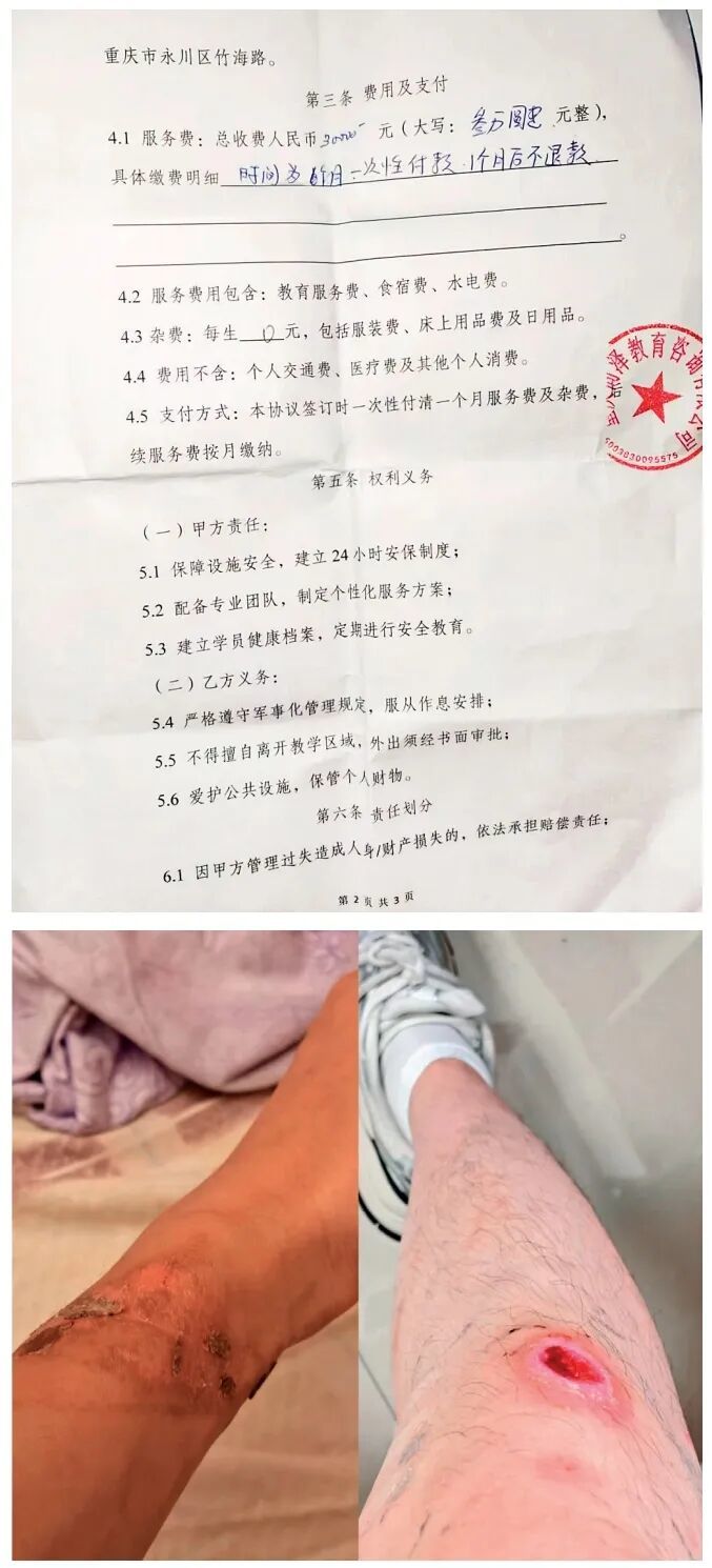 上图：梁宇父母与“戒网瘾”机构签署的服务合同