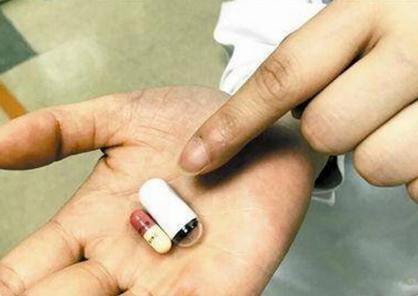 还记得被胃镜, 结肠镜支配的恐惧吗, 这个胶囊大小的机器人来救你了