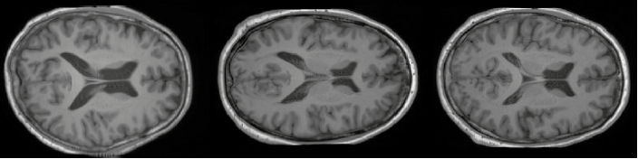 我们的Latent Diffusion Model生成的合成脑图像