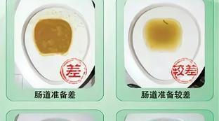 和爽加西甲硅油