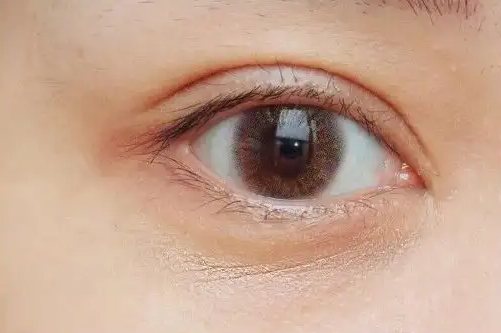 眼部干纹