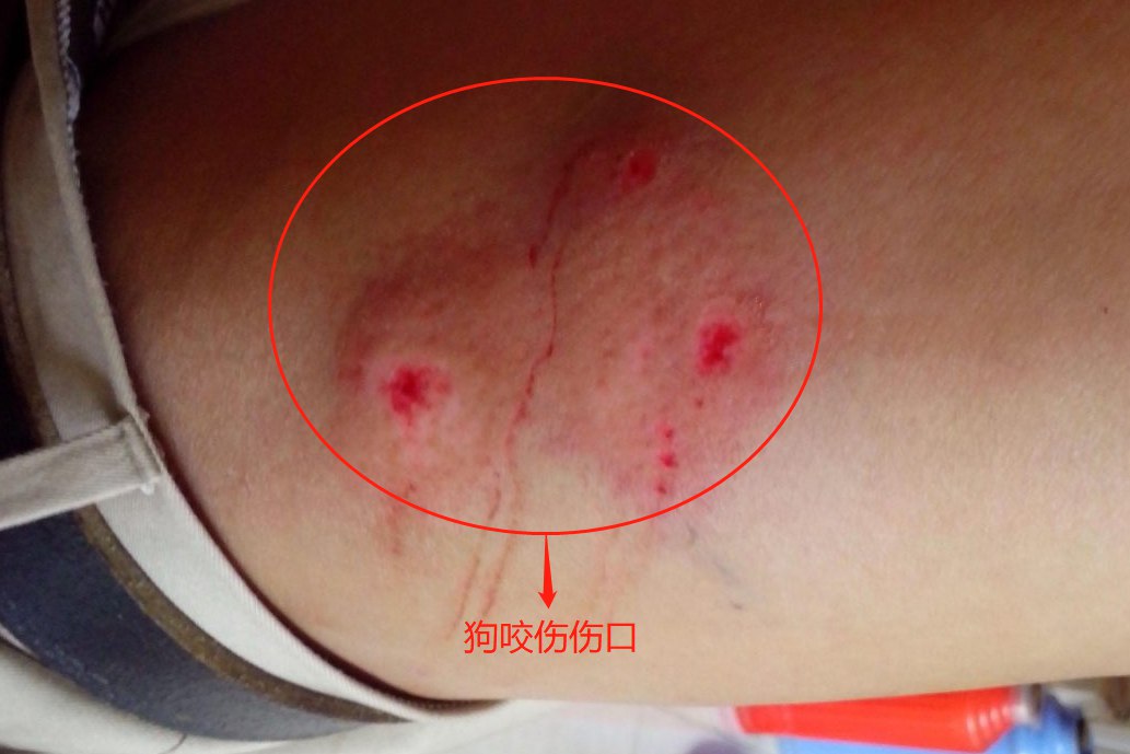 狗咬的伤口图片