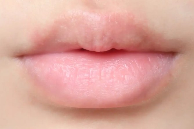 正常唇纹图片