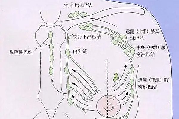 腋窝淋巴结分区图解