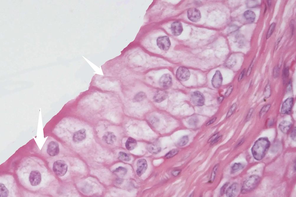 未角化的复层扁平上皮分布
