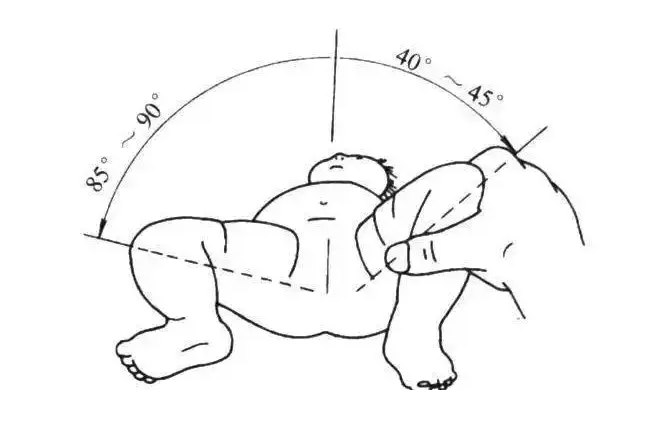 检查髋关节活动