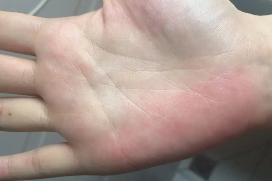 正常人的鬓角