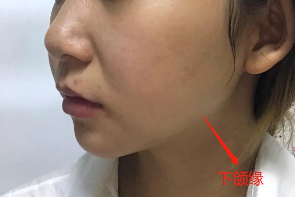 下颌缘