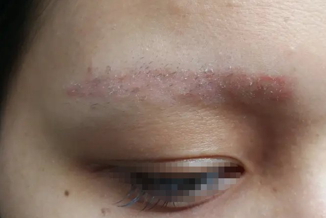 纹眉结痂掉色后的图片