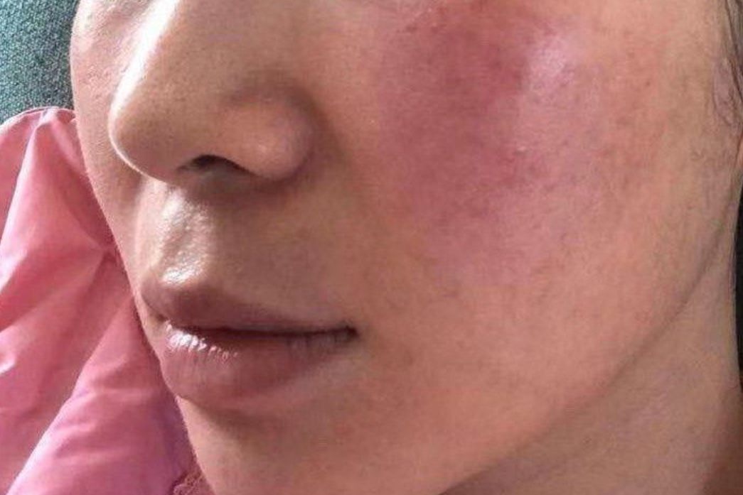 角质层厚的皮肤