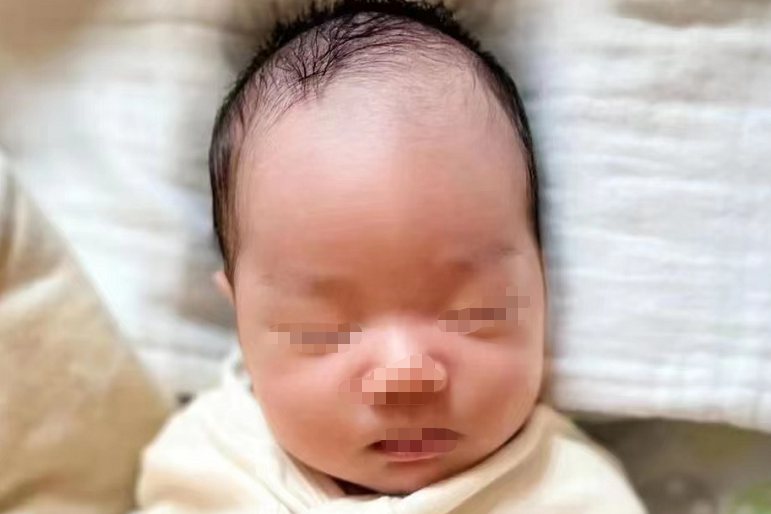 婴儿舟状头图片