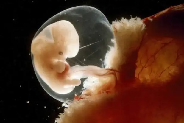 怀孕两个月胎儿图