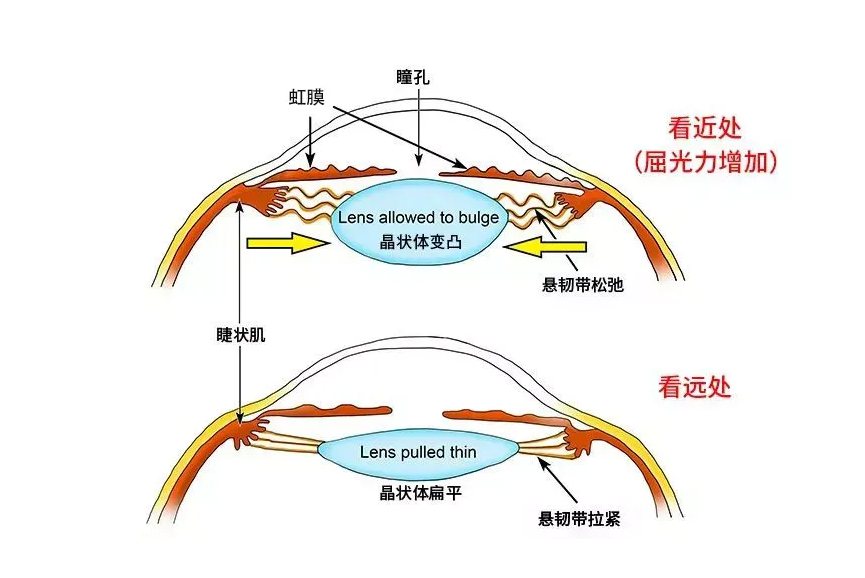 正常晶状体图片