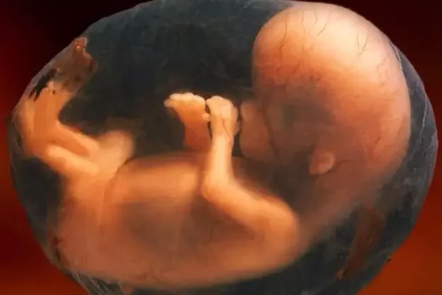 三个月胎儿图片