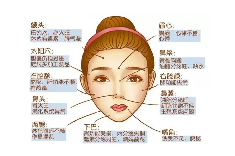 脸上长痘分布图