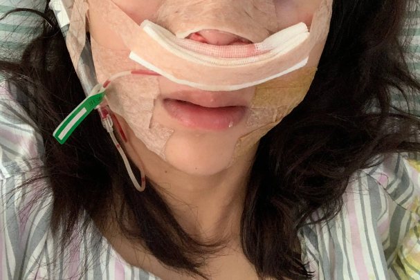 填塞湿润的纱布或棉球