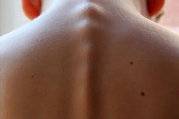 脊柱正常生理情况