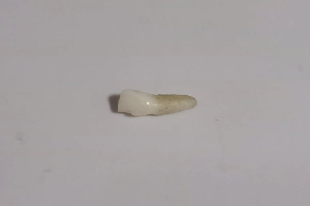 拔下来的门牙牙根
