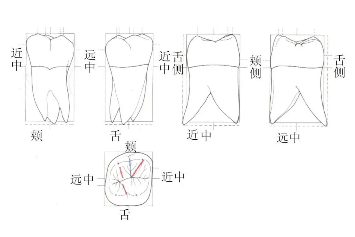 右上颌第一磨牙