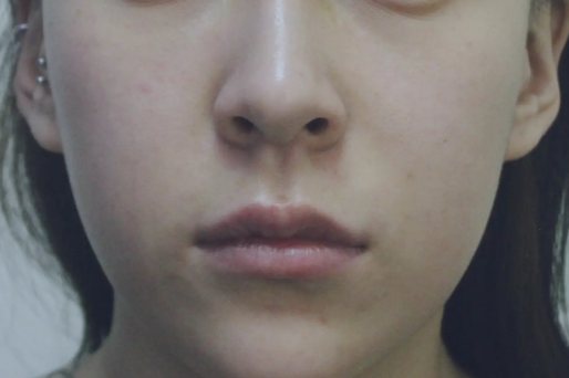 没有苹果肌的脸