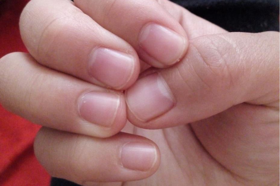指甲正常的颜色