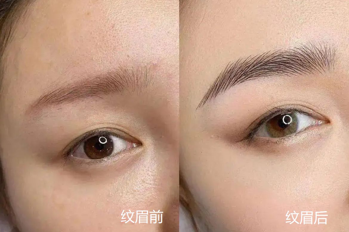 纹眉前后对比