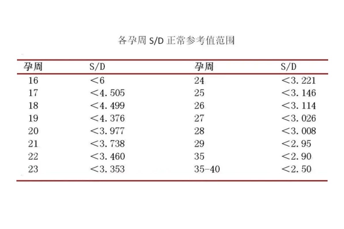 脐动脉血流S/D值