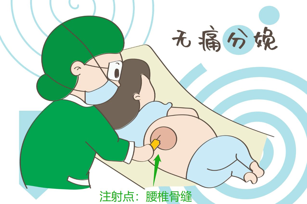 无痛分娩注射位置