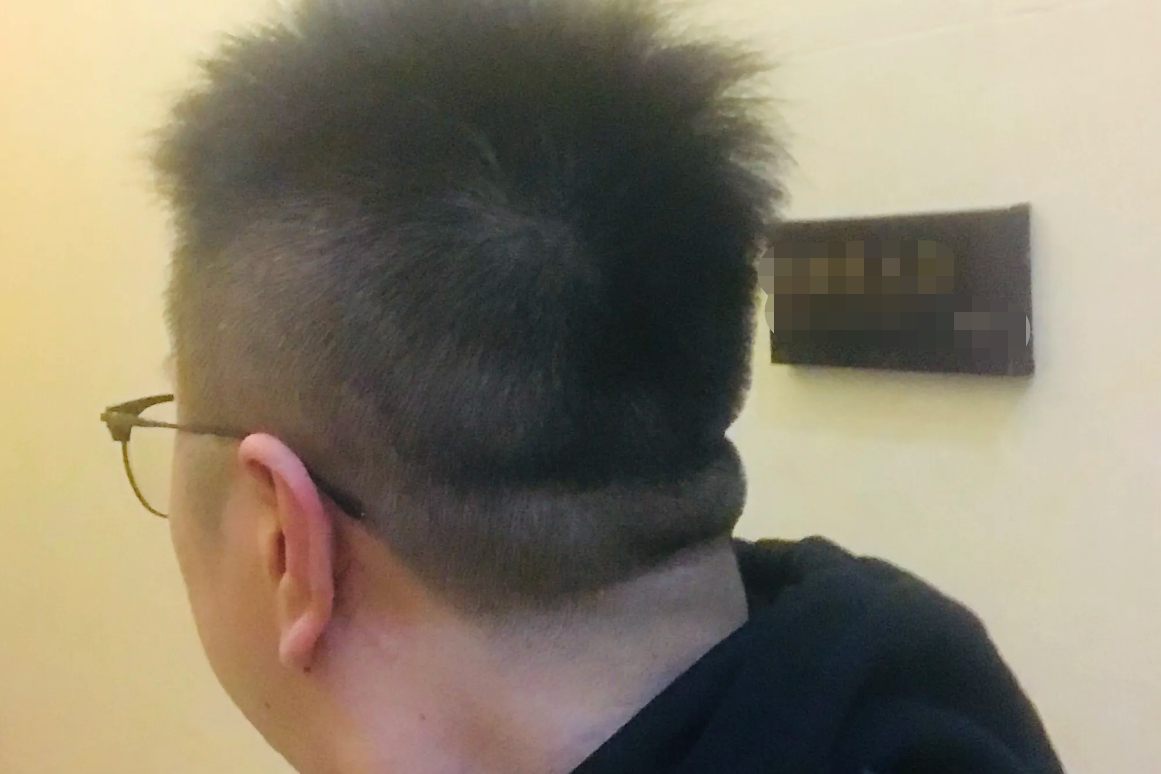 过度肥胖