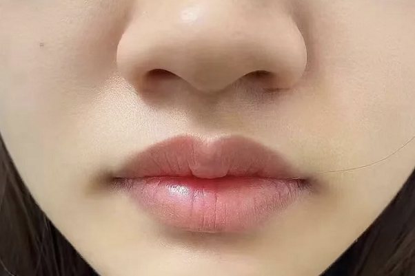 刚做激光洗唇图片