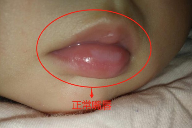 正常嘴唇图片
