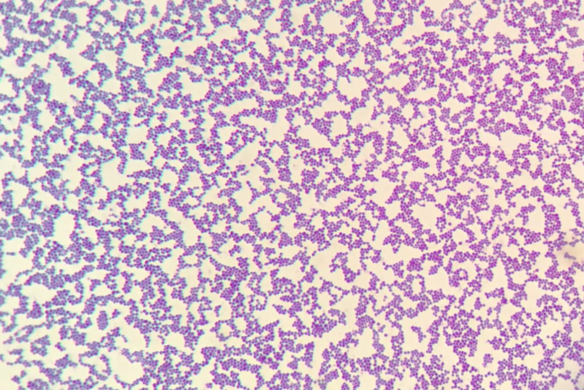 金黄色葡萄球菌