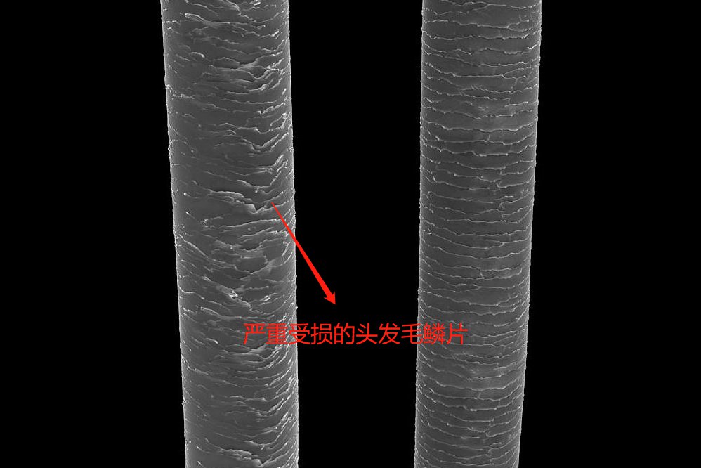 头发毛鳞片严重受损