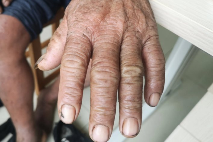 气血不足的手指甲