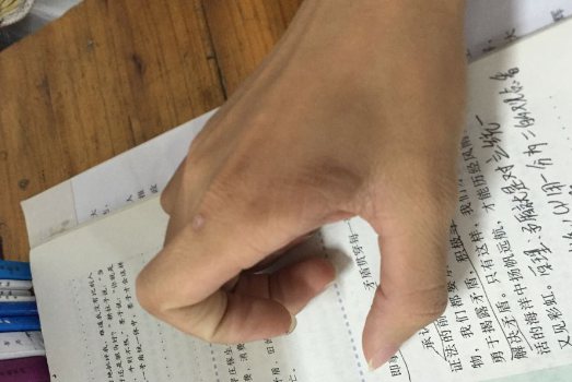 末梢血液循环障碍