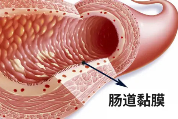 肠粘膜脱落