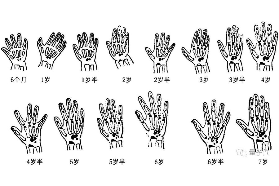 男性骨龄对照表
