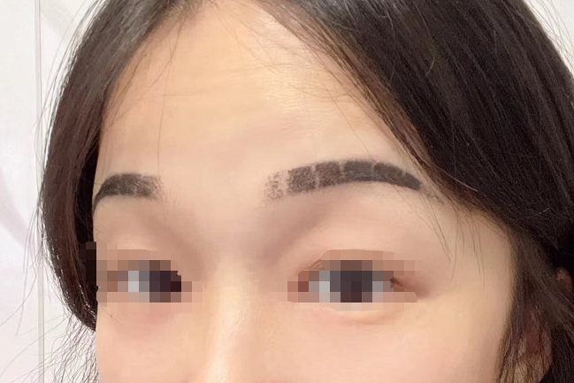 纹眉后掉痂图片