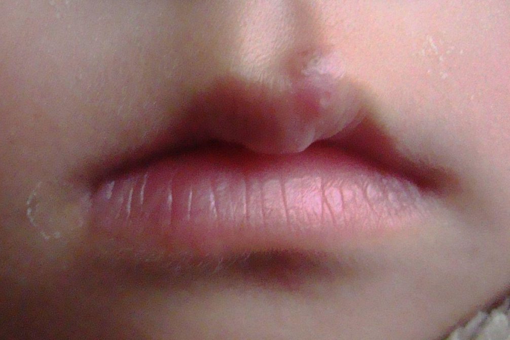 嘴唇鲜红