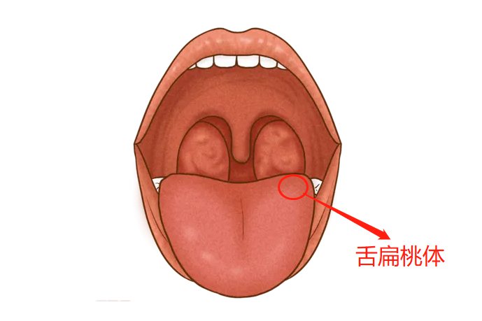 舌扁桃体