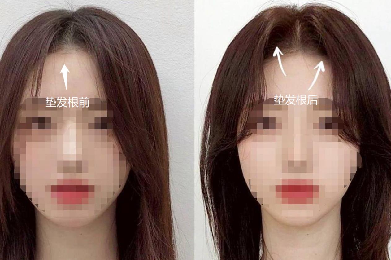垫发根效果对比