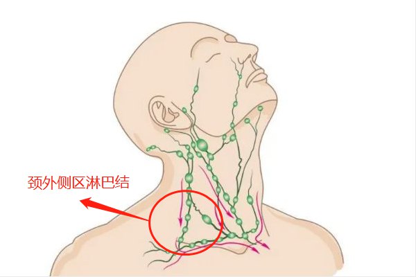颈外侧区淋巴结