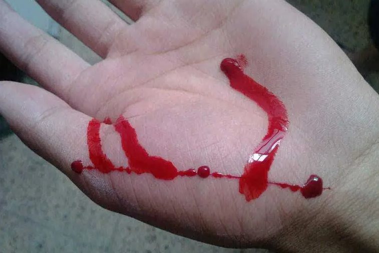 手受伤流血