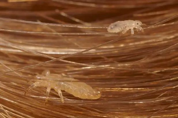 不洗头发长虱子