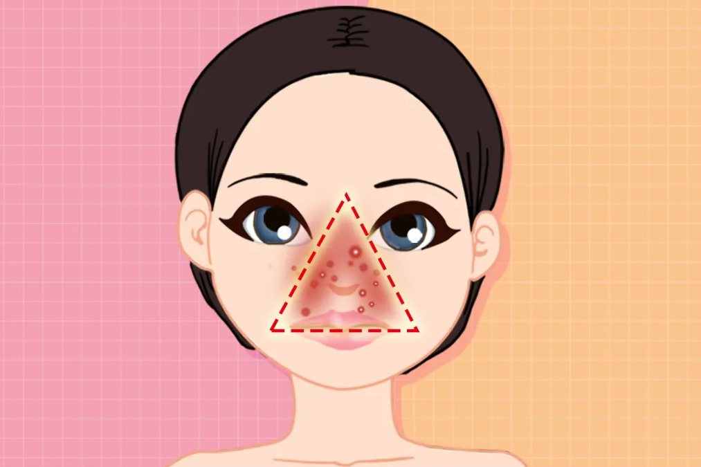 脸上危险三角区