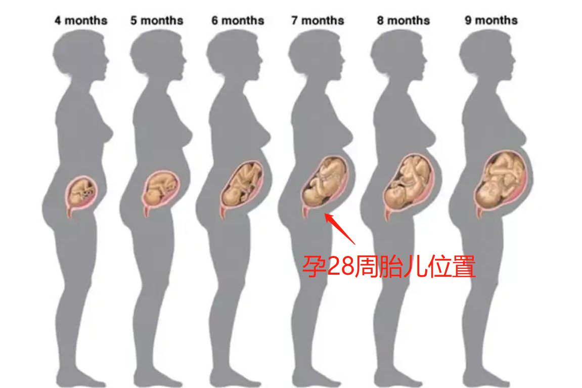 怀孕28周胎儿位置
