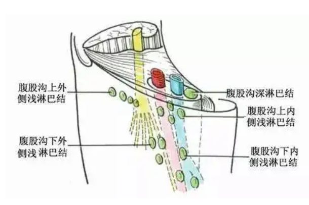 腹股沟区淋巴结