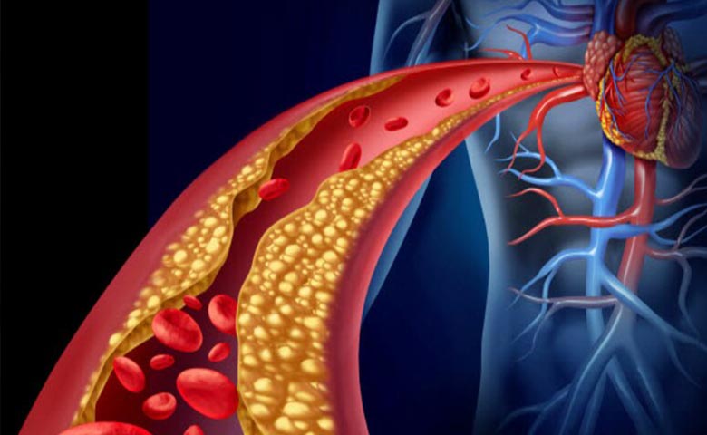 冠心病的护理计划单_冠心病护理计划单的书写范文_冠心病整体护理计划单