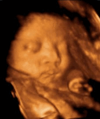 淮北做四维是大排畸吗_四维检查是大排畸吗_四维是大排畸么